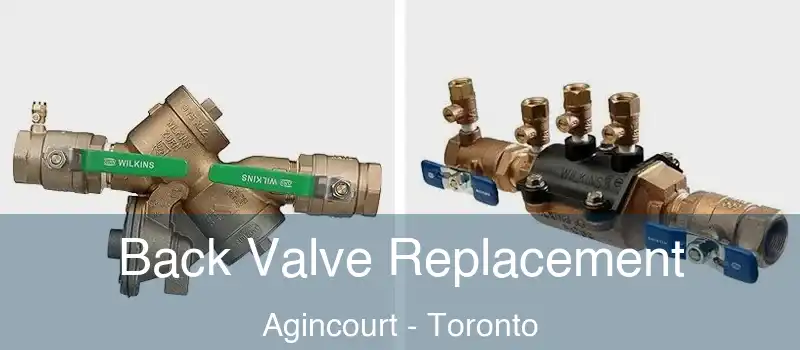 Back Valve Replacement Agincourt - Toronto